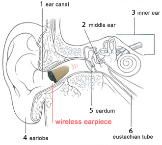 earpiece_in_earcanal